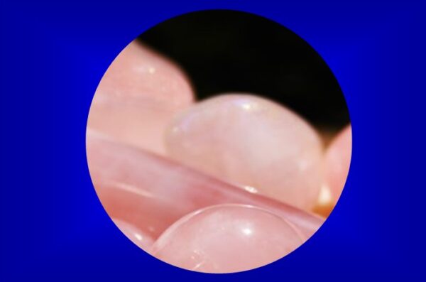 Rozenkwarts betekenis blog